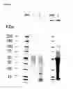 Fig. 06 - Method of preparing plant-derived VLPs