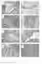 Fig. 14 - Culture medium containing gamma-aminobutyric acid, pipecolic acid or lithium for the maintenance of stem cells in an undifferentiated state