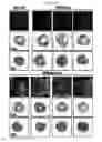 Fig. 06 - Treating cardiovascular tissue