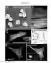 Fig. 08 - Treating cardiovascular tissue