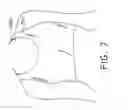 Fig. 07 - Moisture management support garment with a denier differential mechanism