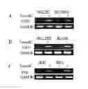 Fig. 06 - DIAGNOSTIC COMPOSITION FOR AUTOIMMUNE DISEASES COMPRISING AGENT MEASURING CD3Z GENE METHYLATION LEVEL AND A METHOD FOR DIAGNOSING AUTOIMMUNE DISEASES USING THE SAME