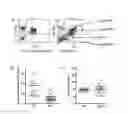 Fig. 07 - DIAGNOSTIC COMPOSITION FOR AUTOIMMUNE DISEASES COMPRISING AGENT MEASURING CD3Z GENE METHYLATION LEVEL AND A METHOD FOR DIAGNOSING AUTOIMMUNE DISEASES USING THE SAME