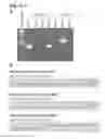 Fig. 07 - COMPOSITIONS AND METHODS FOR IDENTIFYING AND DETECTING SITES OF TRANSLOCATION AND DNA FUSION JUNCTIONS