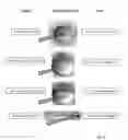 Fig. 04 - HIGH THROUGHPUT METHOD AND SYSTEM FOR IN VIVO SCREENING