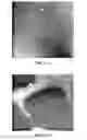 Fig. 15 - Photochemical methods and photoactive compounds for modifying surfaces