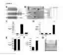 Fig. 04 - NOVEL NETRIN DERIVATIVES AND USES THEREOF