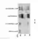 Fig. 04 - Cofactors for Thrombin Activation of Factor VII and Uses Thereof