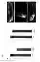Fig. 08 - Compositions and methods for the inhibition of dishevelled proteins