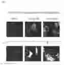 Fig. 14 - Compositions and methods for bone formation and remodeling