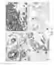 Fig. 07 - Method For The Prevention Of Cancer Metastasis