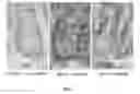 Fig. 04 - NOVEL COMPOUNDS FOR INHIBITING EEF-2 KINASE ACTIVITY