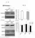 Fig. 06 - Methods for treating frontotemporal lobar degeneration with ubiquitinated inclusions (FTLD-U)