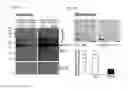 Fig. 07 - Methods for treating frontotemporal lobar degeneration with ubiquitinated inclusions (FTLD-U)
