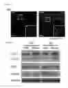 Fig. 08 - Methods for treating frontotemporal lobar degeneration with ubiquitinated inclusions (FTLD-U)