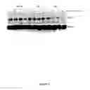 Fig. 06 - Modulation of human cytomegalovirus replication by micro-RNA 132 (miR132), micro-RNA 145 (mi145) and micro-RNA 212 (miR212)