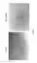 Fig. 02 - Nucleic acids encoding peptides for treating wounds, anti-angiogenic compounds and uses thereof