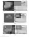 Fig. 07 - Process and apparatus for depositing nanostructured material onto a substrate material