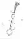 Fig. 02 - Orienting a brachytherapy applicator