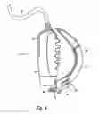 Fig. 06 - System and method for viewing oropharyngeal area