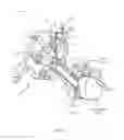Fig. 02 - Surgical access system and related methods