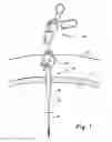 Fig. 02 - Access sealing apparatus and method