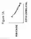 Fig. 02 - Non-invasive method for measuring changes in body position and respiration