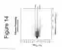 Fig. 16 - Non-invasive method for measuring changes in body position and respiration