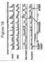 Fig. 18 - Non-invasive method for measuring changes in body position and respiration