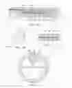 Fig. 03 - Impedance spectroscopy system and catheter for ischemic mucosal damage monitoring in hollow viscous organs