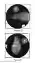 Fig. 04 - Methods and systems for prolonged localization of drug delivery