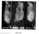 Fig. 12 - Methods and systems for prolonged localization of drug delivery