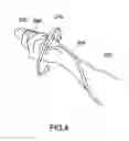 Fig. 04 - MEDICAL DEVICE WITH MOTION SENSING