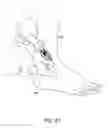 Fig. 96 - IMAGING-GUIDED JOINT INJECTION SYSTEM
