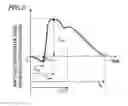 Fig. 06 - Ultrasonic diagnostic device, and method for measuring initma-media complex thickness