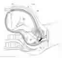 Fig. 01 - Fetal scalp doppler device and system