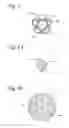 Fig. 03 - SYSTEMS, DEVICES AND METHODS FOR ASSESSMENT OF BODY CAVITY PRESSURES