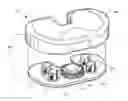 Fig. 01 - Device and method of spacer and trial design during joint arthroplasty