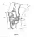 Fig. 09 - Device and method of spacer and trial design during joint arthroplasty