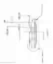 Fig. 11 - Device and method of spacer and trial design during joint arthroplasty