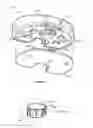 Fig. 35 - Device and method of spacer and trial design during joint arthroplasty