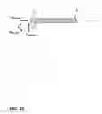 Fig. 33 - Spinal probe with tactile force feedback and pedicle breach prediction