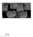 Fig. 43 - Spinal probe with tactile force feedback and pedicle breach prediction