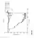 Fig. 44 - Spinal probe with tactile force feedback and pedicle breach prediction
