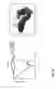 Fig. 53 - Spinal probe with tactile force feedback and pedicle breach prediction