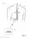 Fig. 02 - Associating therapy adjustments with posture states using a stability timer