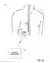 Fig. 04 - Associating therapy adjustments with posture states using a stability timer