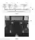 Fig. 03 - Method and system for treating amblyopia