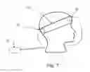 Fig. 07 - Method and system for treating amblyopia