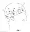 Fig. 02 - Support assembly for an ear